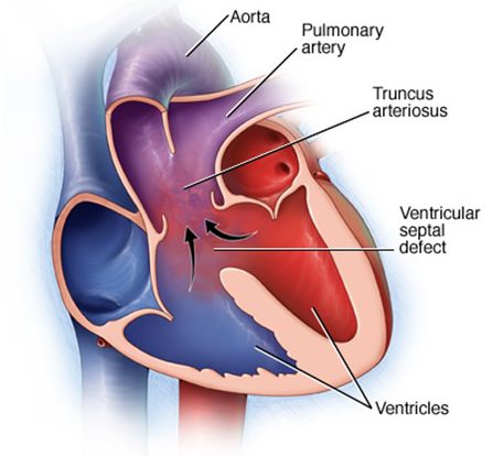 single post thumbnail