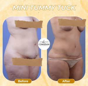 single post thumbnail